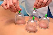 Cupping therapy in Gurgaon | Cupping therapy Treatment