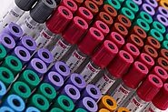 HMD – Top Manufacturer of Blood Sample Tubes