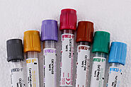 Unravelling the Mystery Behind Blood Collection Tube Colours