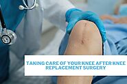 How To Take Care Of Your Knee After Knee Replacement – Complete Guide