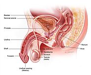 Diagnosis of prostate cancer