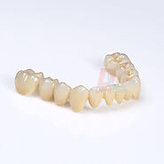 Zirconia Crown-Strong, Long lasting, Translucent | DentCare Dental Lab