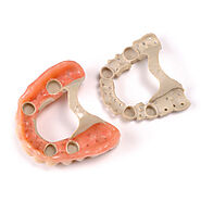 PEEK Dental Material -Alternative to traditional metal | DentCare Dental Lab