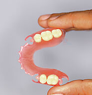 Flexible Dentures - Removable Partial Dentures | DentCare Dental Lab