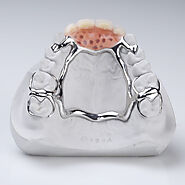 Light weight strong cost-effective Cast Partial Denture | DentCare Dental Lab