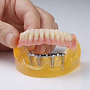 Hybrid Dentures from Expert Implant Specialists | DentCare Dental Lab