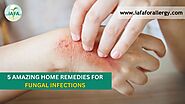 5 Amazing Home Remedies for Fungal Infections