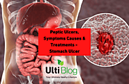 Stomach Ulcer – Causes & Treatments – Peptic Ulcers