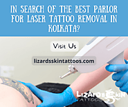 In Search Of The Best Parlor For Laser Tattoo Removal In Kolkata?