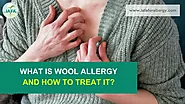 What is Wool Allergy and How to Treat It?