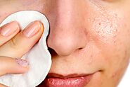 Natural Remedies for Blackheads You Can Use at Home | The Healthy