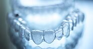 Reasons Why You Should Choose Invisalign