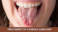 What is Candida Albicans and How to Treat it?