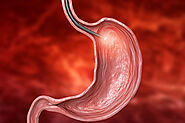 Endoscopy Procedure Singapore: Everything You Need to Know | Arden JR Surgery