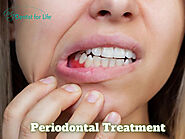 Get the Best Periodontal Treatment in Plantation