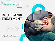 Best Root Canal Treatment in Plantation, FL