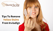 Ways To Remove Of Yellow Stains From Your Invisalign