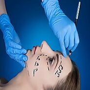 Facelift Surgery in Faridabad performed by Dr. Kiranmayi Atla