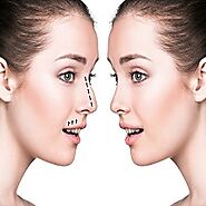 Best Rhinoplasty Clinic In Faridabad, The Beauty And The Cut