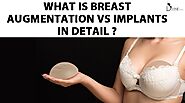 What is Breast Augmentation vs Implants in Detail