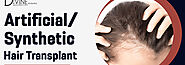 Artificial / Synthetic Hair Transplant : Know it’s Significance