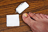 How to Remove an Ingrown Nail