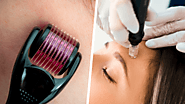 Microdermabrasion Vs Dermarolling : Most Popular Skin Treatments – House Of Beauty India