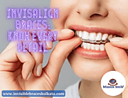 Invisalign Braces: Know Every Detail