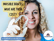 Invisible Braces: What Are Their Cost?