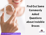 Find Out Some Commonly Asked Questions About Invisible Braces