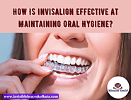 How Is Invisalign Effective at Maintaining Oral Hygiene?