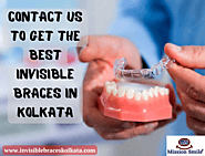 Contact Us To Get The Best Invisible Braces In Kolkata