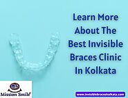 Learn More About The Best Invisible Braces Clinic In Kolkata