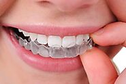 How Invisible Braces Can Help You | Invisible Braces Kolkata