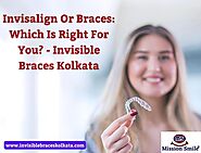Invisalign Or Braces: Which Is Right For You? - Invisible Braces Kolkata