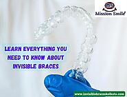 Learn Everything You Need To Know About Invisible Braces | Invisible Braces Kolkata