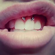A Smiley Piercing Example Pictures And What To Know Before