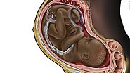 Publicarán libro con las ilustraciones médicas del creador de la imagen viral de un feto negro
