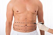 7 Steps to Take to Recover from Liposuction Surgery – Cosmetic Surgery Clinic Dubai | best plastic surgery clinic | c...