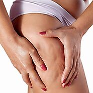 Cellulite Removal Treatment in Dubai, Abu Dhabi & Sharjah | LPG Cellulite