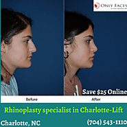 Rhinoplasty specialist in Charlotte explains what to know before getting a nose job