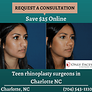 Teen rhinoplasty surgeons in Charlotte NC: facts about teen nose jobs