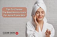Tips to Choose the Best Moisturizers for Acne Prone Skin
