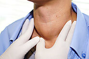 What Is Hyperthyroidism - How To Treat It Naturally