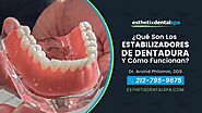 ¿Qué son los estabilizadores de dentadura y cómo funcionan? | Esthetix Dental Spa