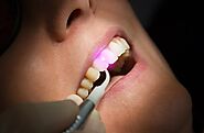 Avail Advanced Dental Treatments with UltraDent Lasers