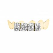 Admirable Top Grillz With Diamond - Exotic Diamonds