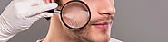 Acne Clearing Treatment for Men’s Skin - MySkin