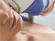 Best Scar Reduction Treatment for Men’s - MySkin
