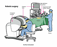 Robotic Surgery in Mumbai | Dr. Yusuf Saifee